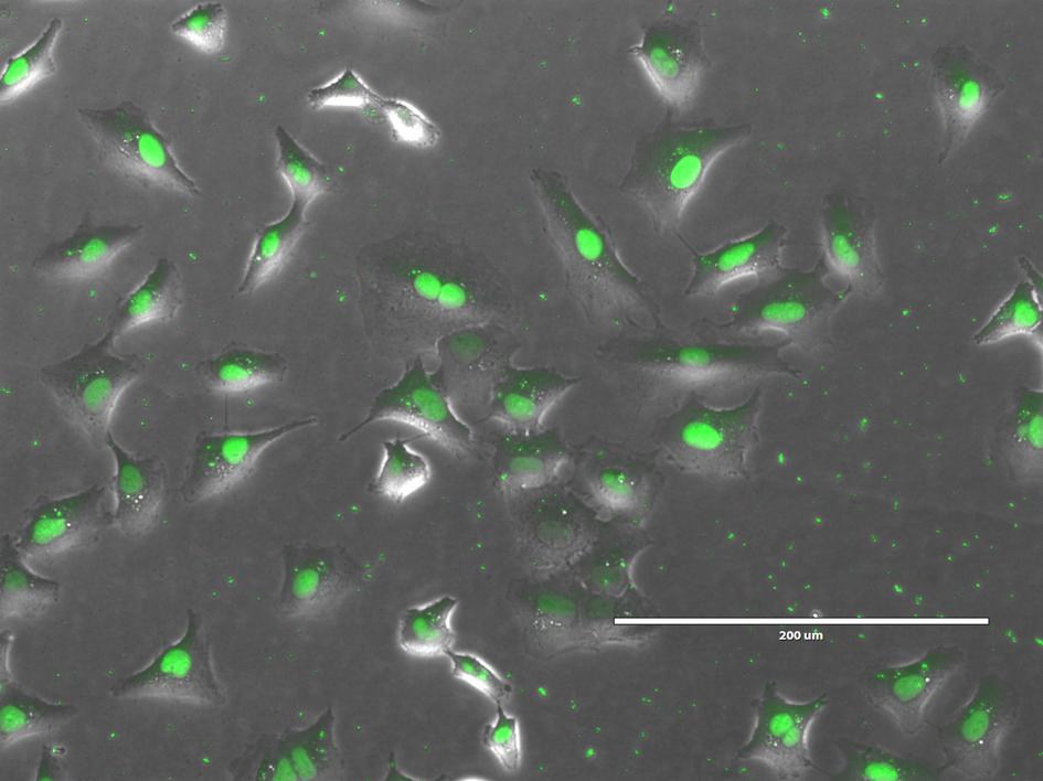 Lung cancer cells